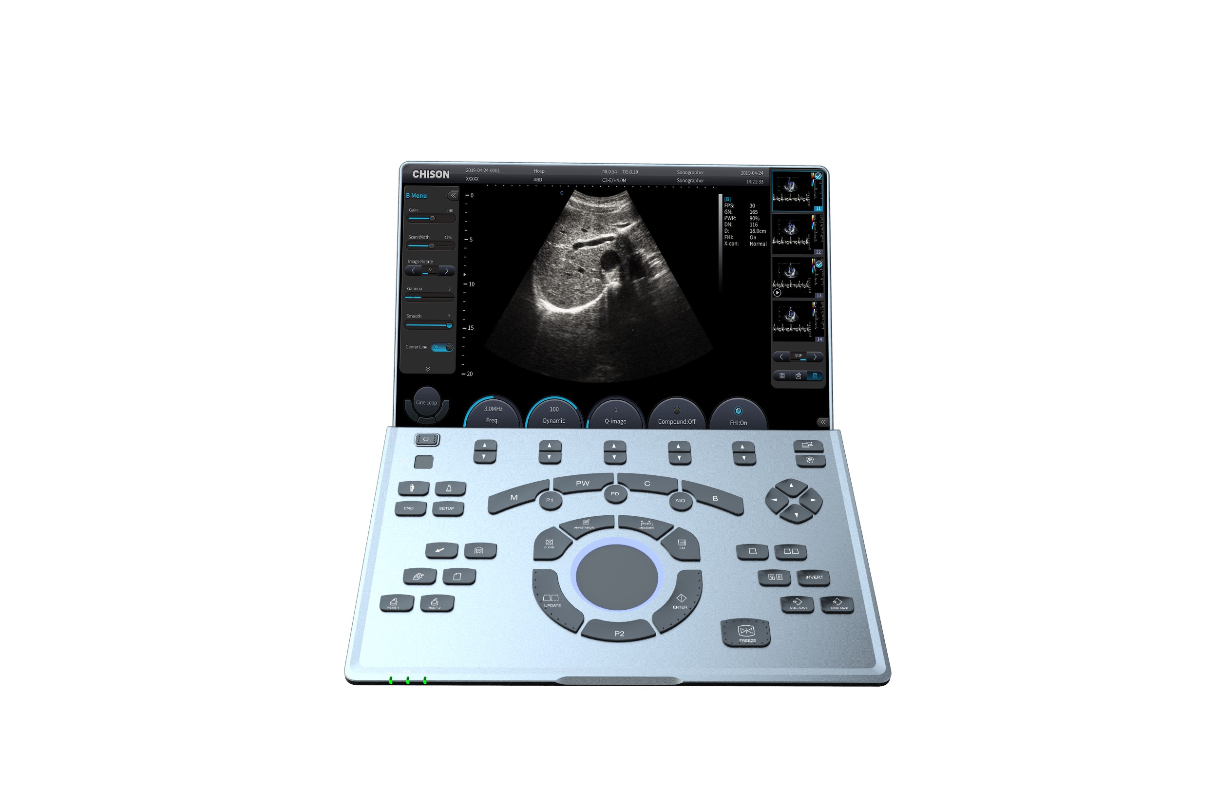 Ultrasonografy mobilne przyłóżkowe CHISON SonoAIR 30