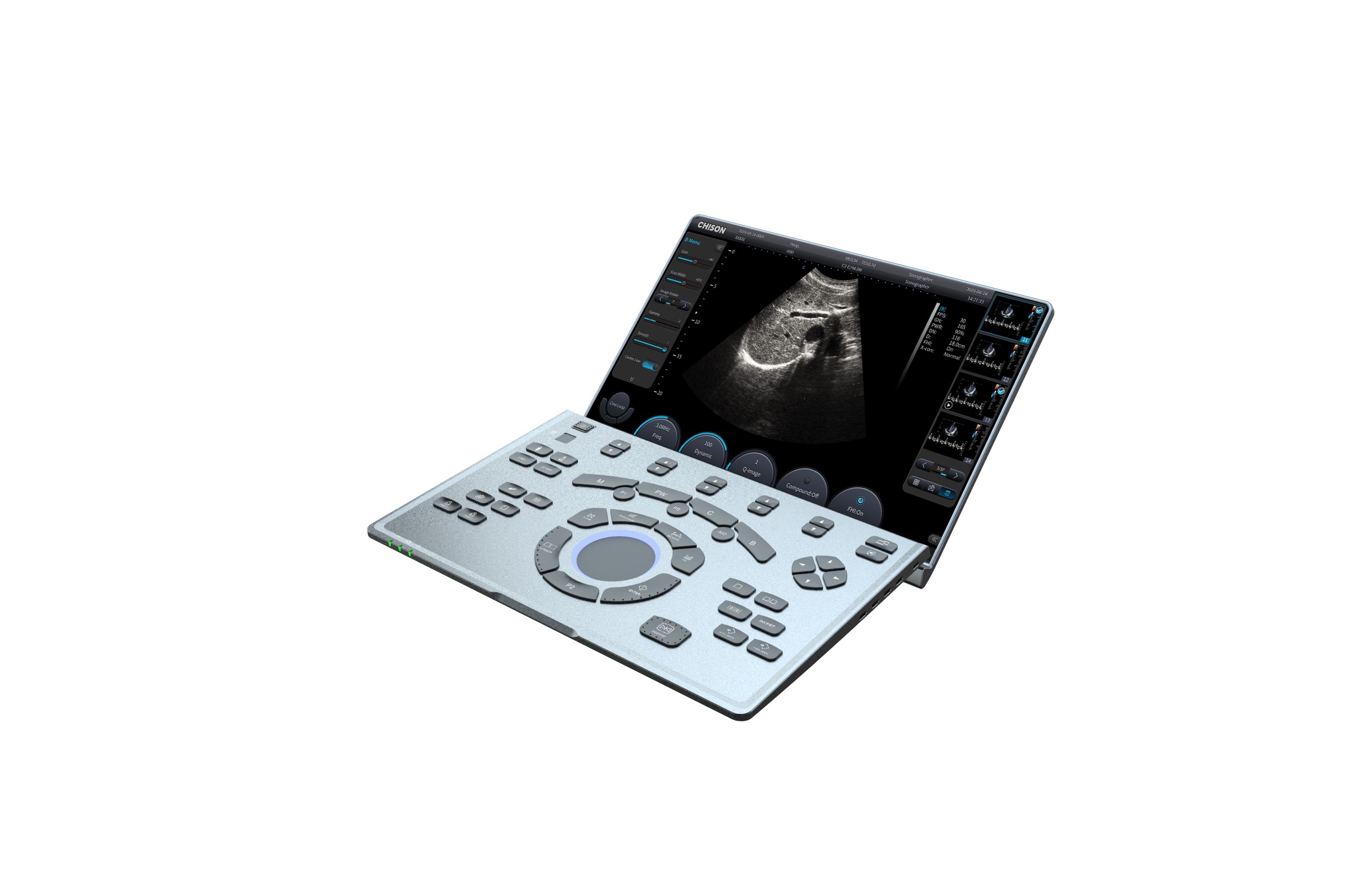 Ultrasonografy mobilne przyłóżkowe CHISON SonoAIR 30
