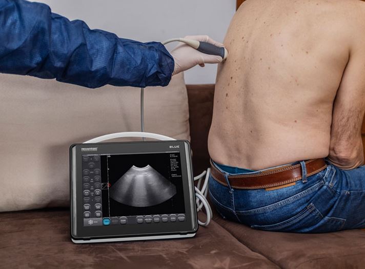 Ultrasonografy mobilne przyłóżkowe DRAMIŃSKI Blue