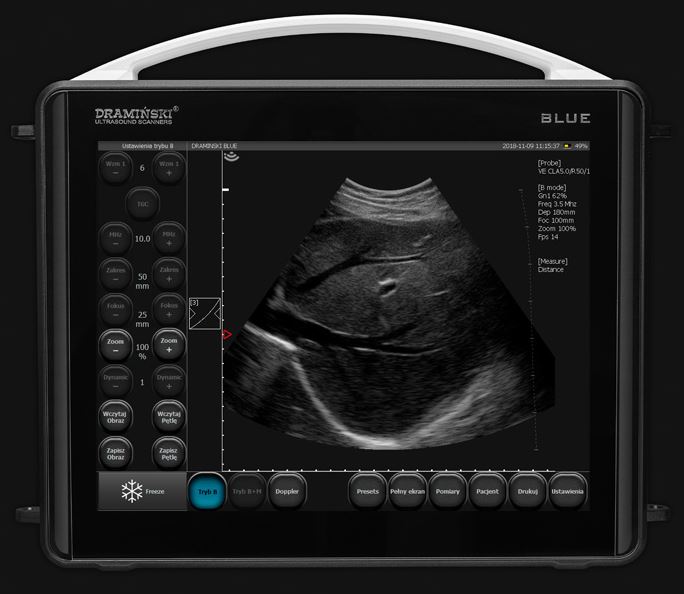 Ultrasonografy mobilne przyłóżkowe DRAMIŃSKI Blue