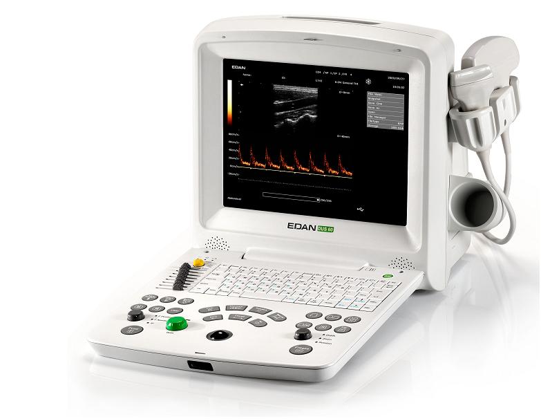 Ultrasonografy mobilne przyłóżkowe EDAN DUS60