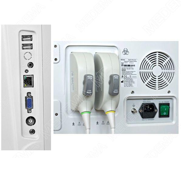 Ultrasonografy mobilne przyłóżkowe EDAN DUS60