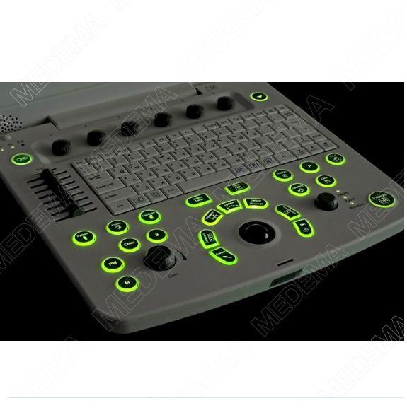 Ultrasonografy mobilne przyłóżkowe EDAN U50