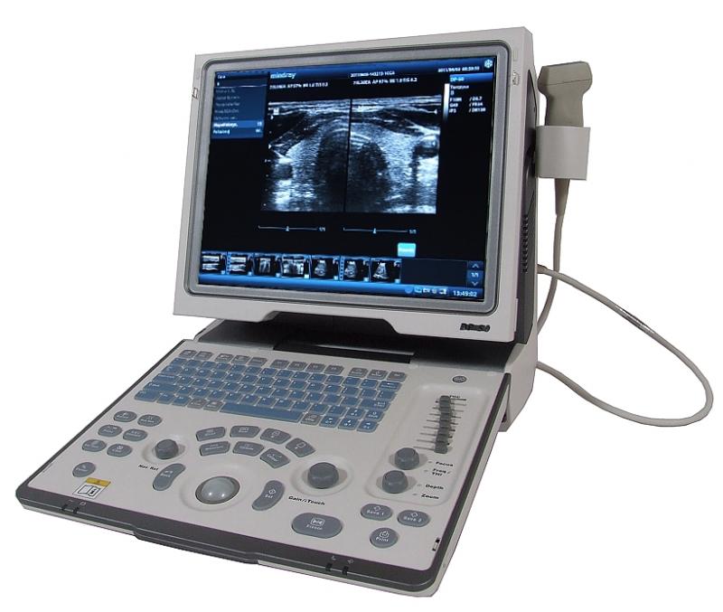 Ultrasonografy mobilne przyłóżkowe MINDRAY DP-50