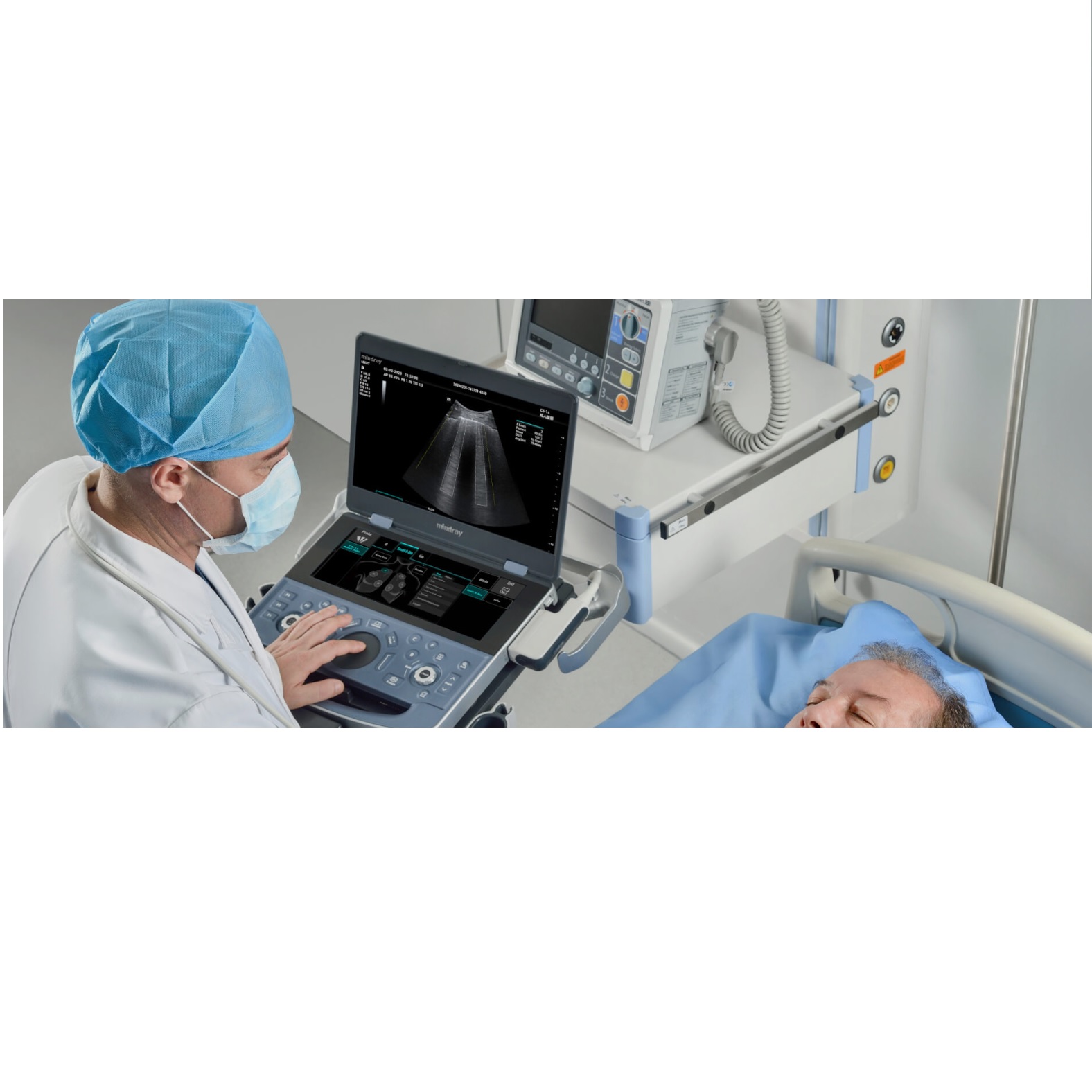 Ultrasonografy mobilne przyłóżkowe MINDRAY ME Series
