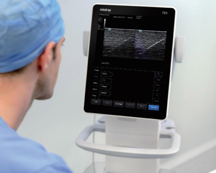 Ultrasonografy mobilne przyłóżkowe MINDRAY TE5
