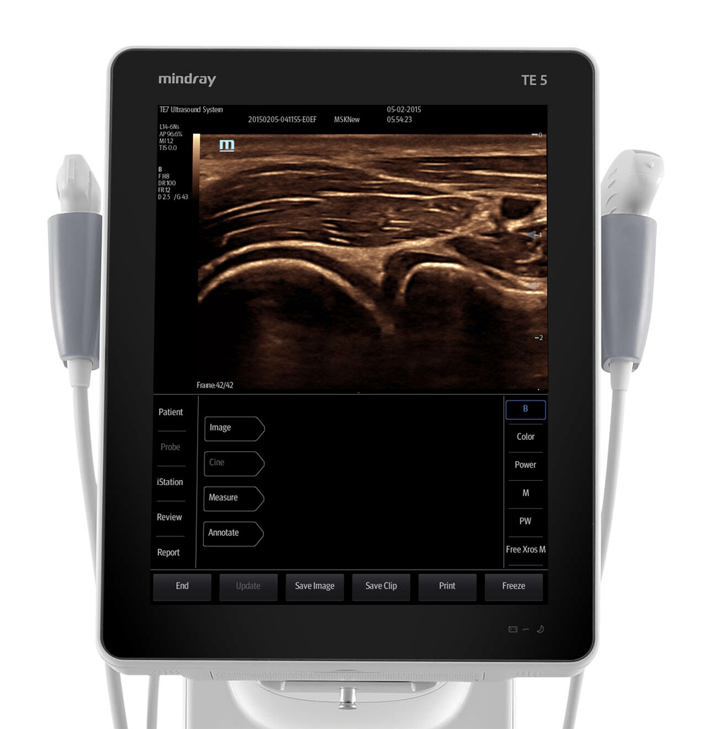 Ultrasonografy mobilne przyłóżkowe MINDRAY TE5