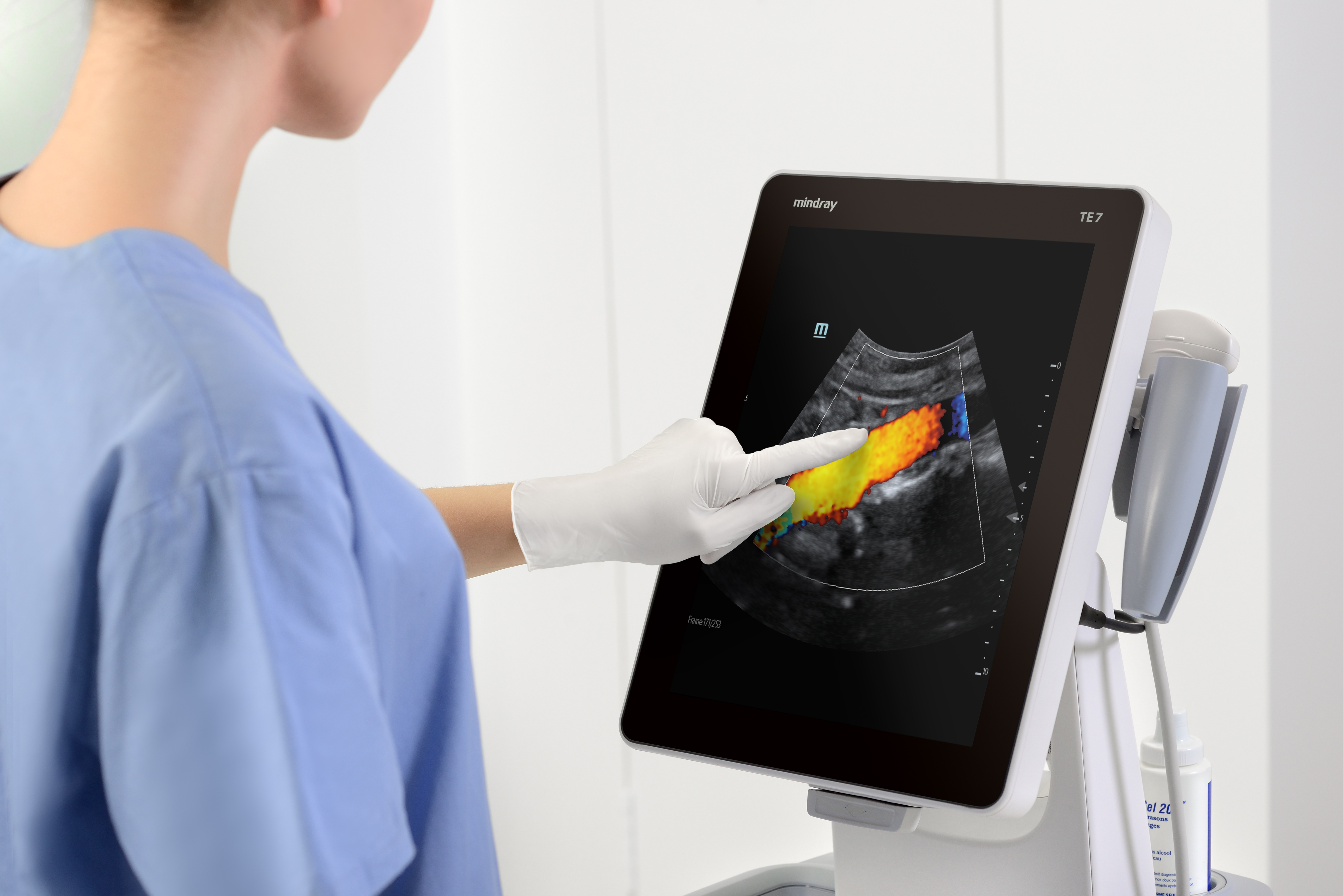 Ultrasonografy mobilne przyłóżkowe MINDRAY TE7
