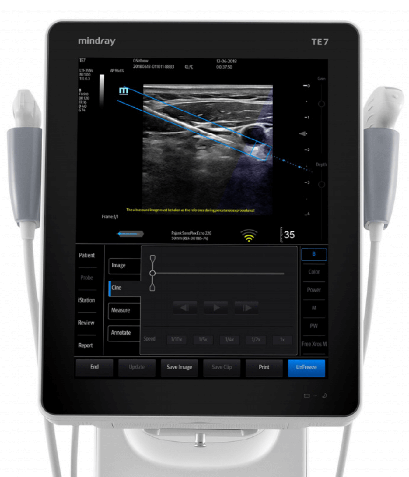 Ultrasonografy mobilne przyłóżkowe MINDRAY TE7
