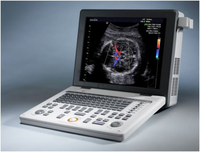 Ultrasonografy mobilne przyłóżkowe Samsung SonoAce R3