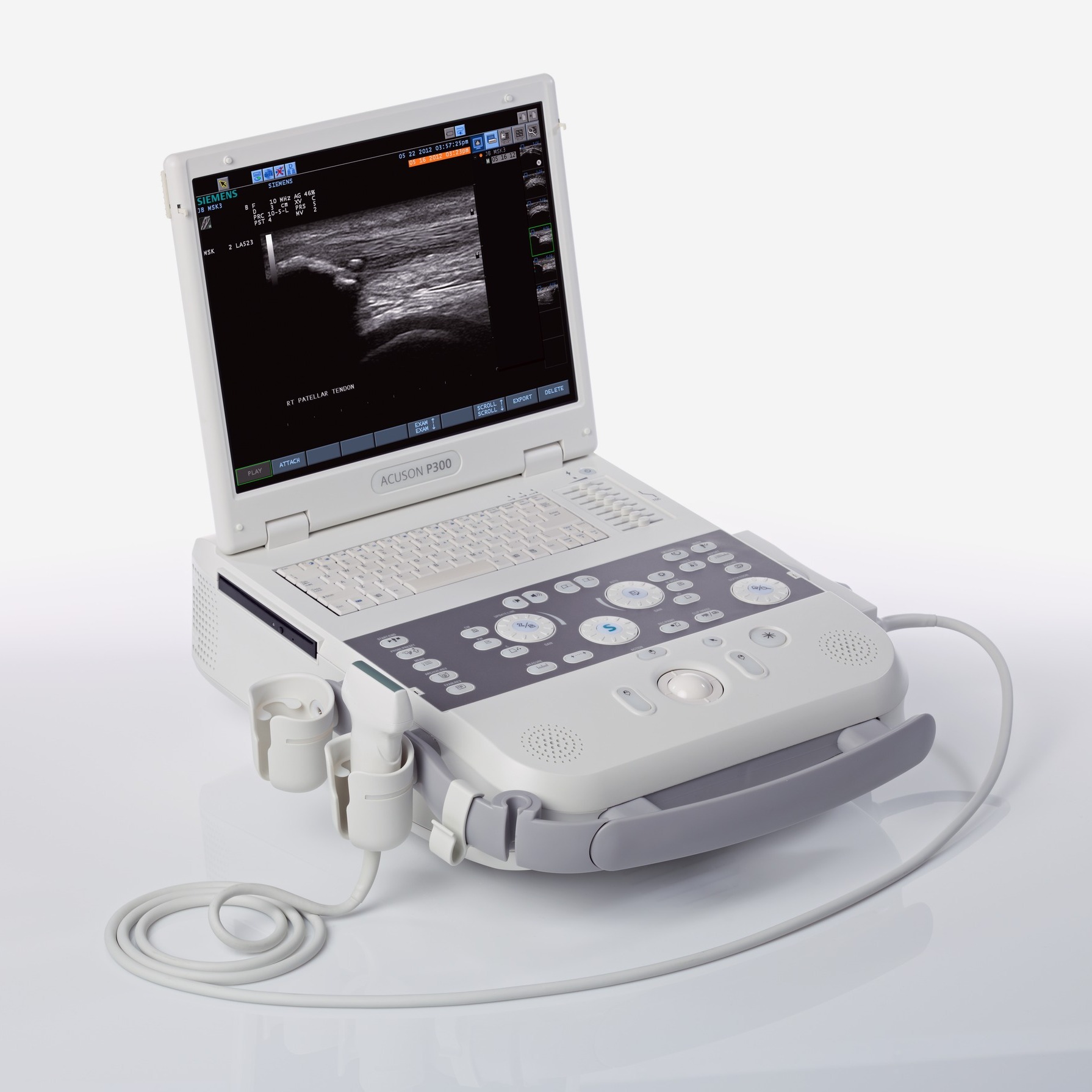 Ultrasonografy mobilne przyłóżkowe Siemens Acuson P300