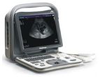 Ultrasonografy mobilne przyłóżkowe SonoScape A6