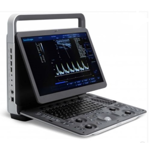 Ultrasonografy mobilne przyłóżkowe SonoScape E1