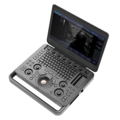 Ultrasonografy mobilne przyłóżkowe SonoScape X3