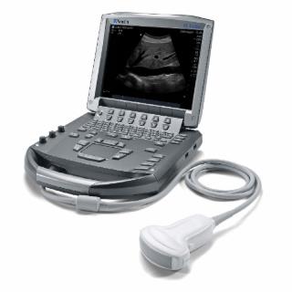Ultrasonografy mobilne przyłóżkowe SonoSite M-Turbo