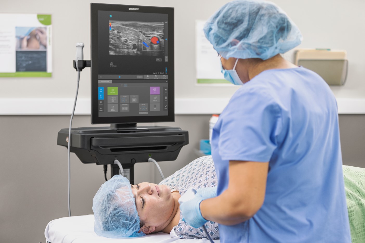 Ultrasonografy mobilne przyłóżkowe SonoSite SonoSite ST