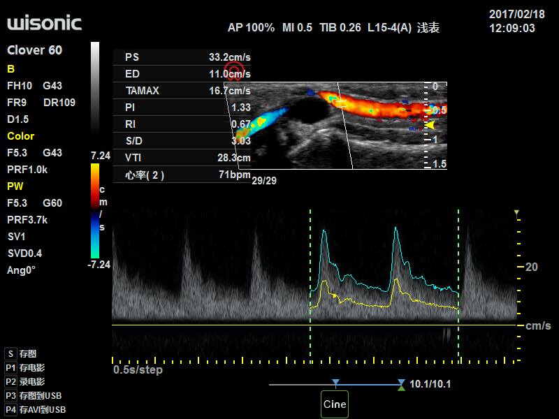 Ultrasonografy mobilne przyłóżkowe Wisonic Clover 60