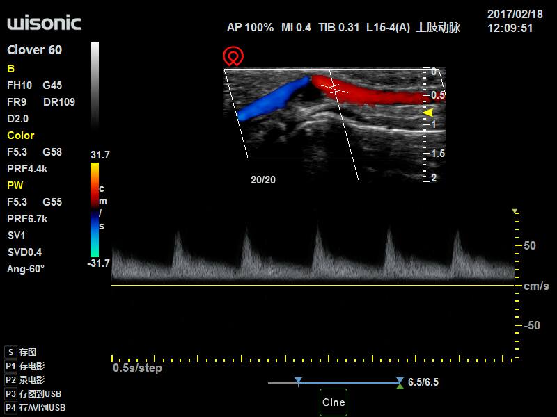 Ultrasonografy mobilne przyłóżkowe Wisonic Clover 60