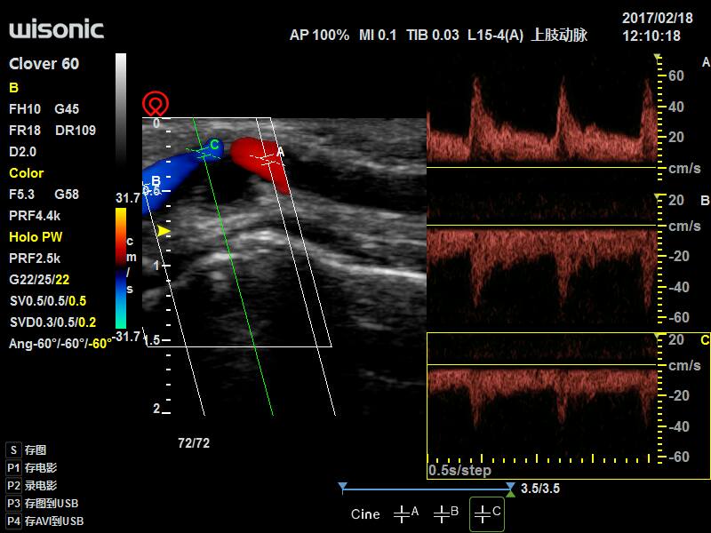 Ultrasonografy mobilne przyłóżkowe Wisonic Clover 60