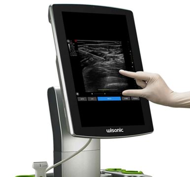 Ultrasonografy mobilne przyłóżkowe Wisonic Navi