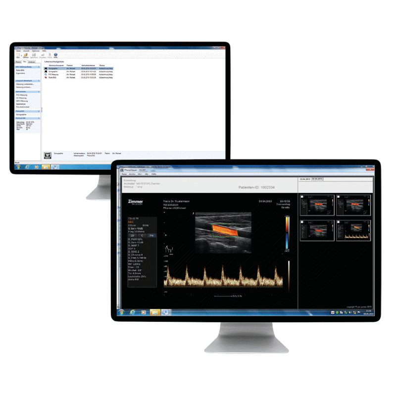 Ultrasonografy mobilne przyłóżkowe Zimmer SonidoSmart Pro