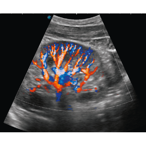 Ultrasonografy mobilne przyłóżkowe Zimmer SonidoSmart Pro