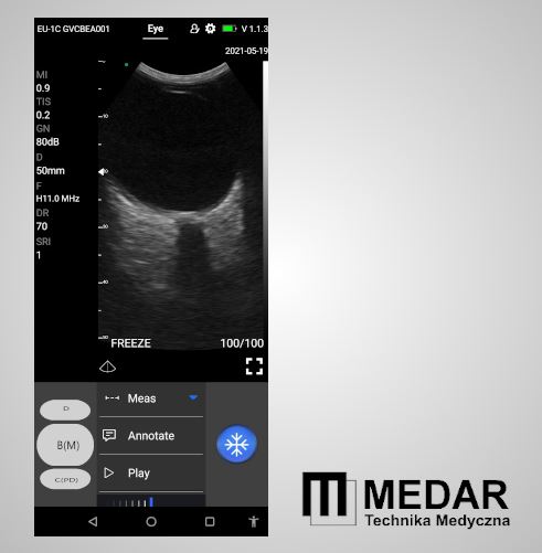 Ultrasonografy okulistyczne SonopTek EU-1C