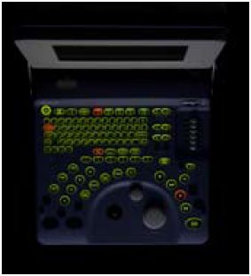 Ultrasonografy stacjonarne wielonarządowe - USG ALOKA Aloka ProSound 2