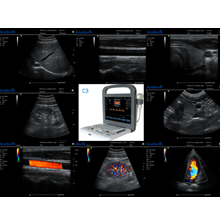 Ultrasonografy stacjonarne wielonarządowe - USG Anasonic C3