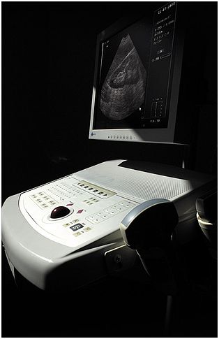 Ultrasonografy stacjonarne wielonarządowe - USG ECHO-SON Desmin F