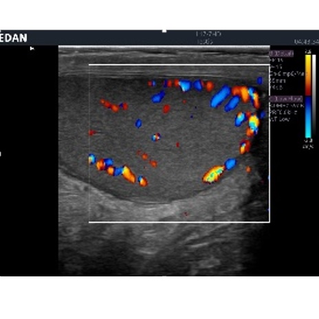 Ultrasonografy stacjonarne wielonarządowe - USG EDAN Acclarix LX8