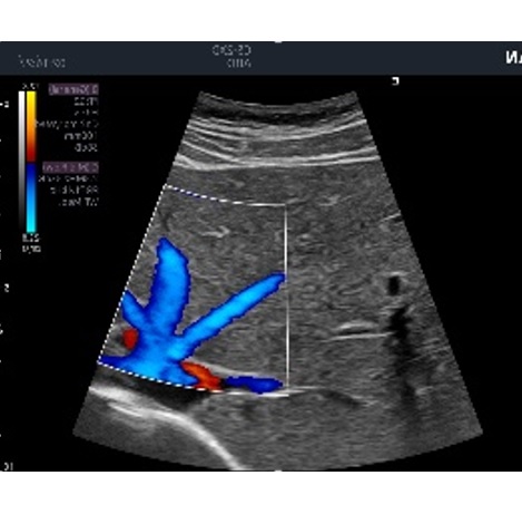 Ultrasonografy stacjonarne wielonarządowe - USG EDAN Acclarix LX8