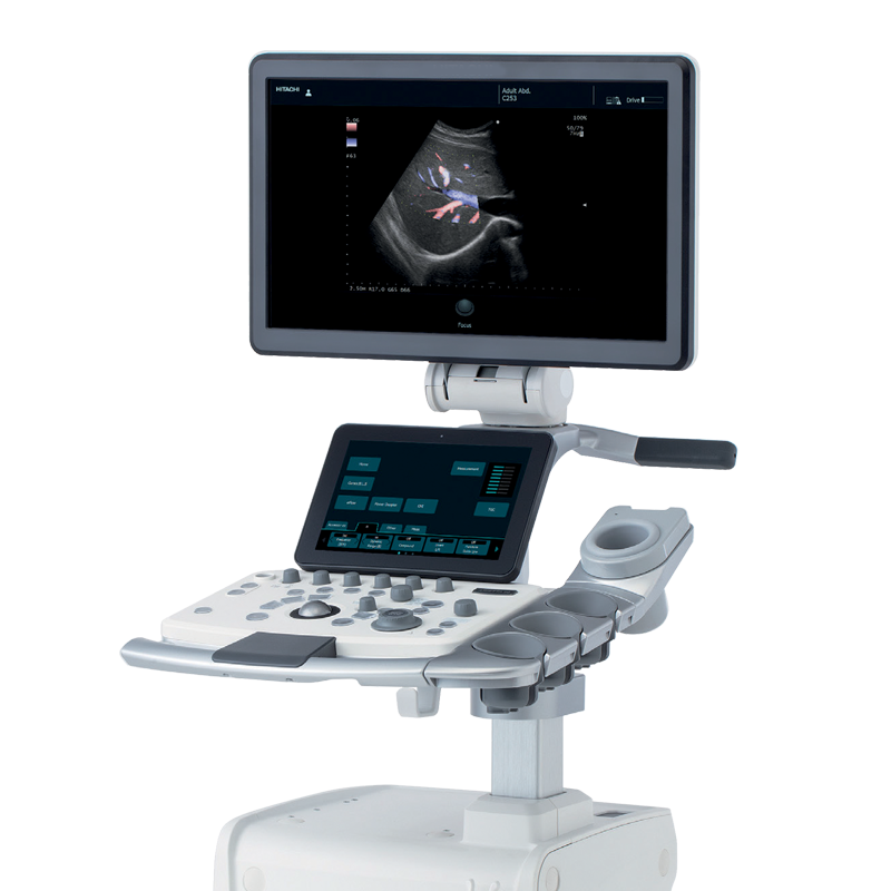 Ultrasonografy stacjonarne wielonarządowe - USG FUJIFILM Arietta 50