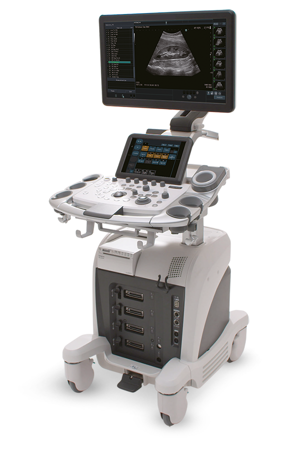 Ultrasonografy stacjonarne wielonarządowe - USG FUJIFILM Arietta 65