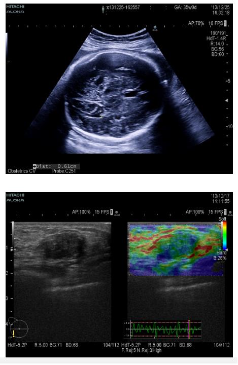 Ultrasonografy stacjonarne wielonarządowe - USG FUJIFILM ARIETTA V60
