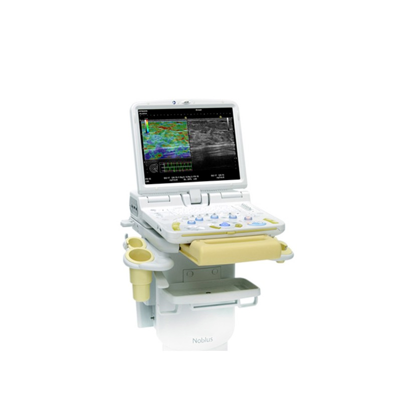 Ultrasonografy stacjonarne wielonarządowe - USG FUJIFILM Noblus