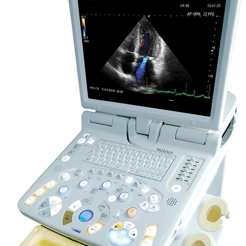 Ultrasonografy stacjonarne wielonarządowe - USG FUJIFILM Noblus