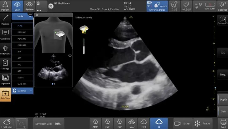 Ultrasonografy stacjonarne wielonarządowe - USG GE Healthcare Venue Sprint
