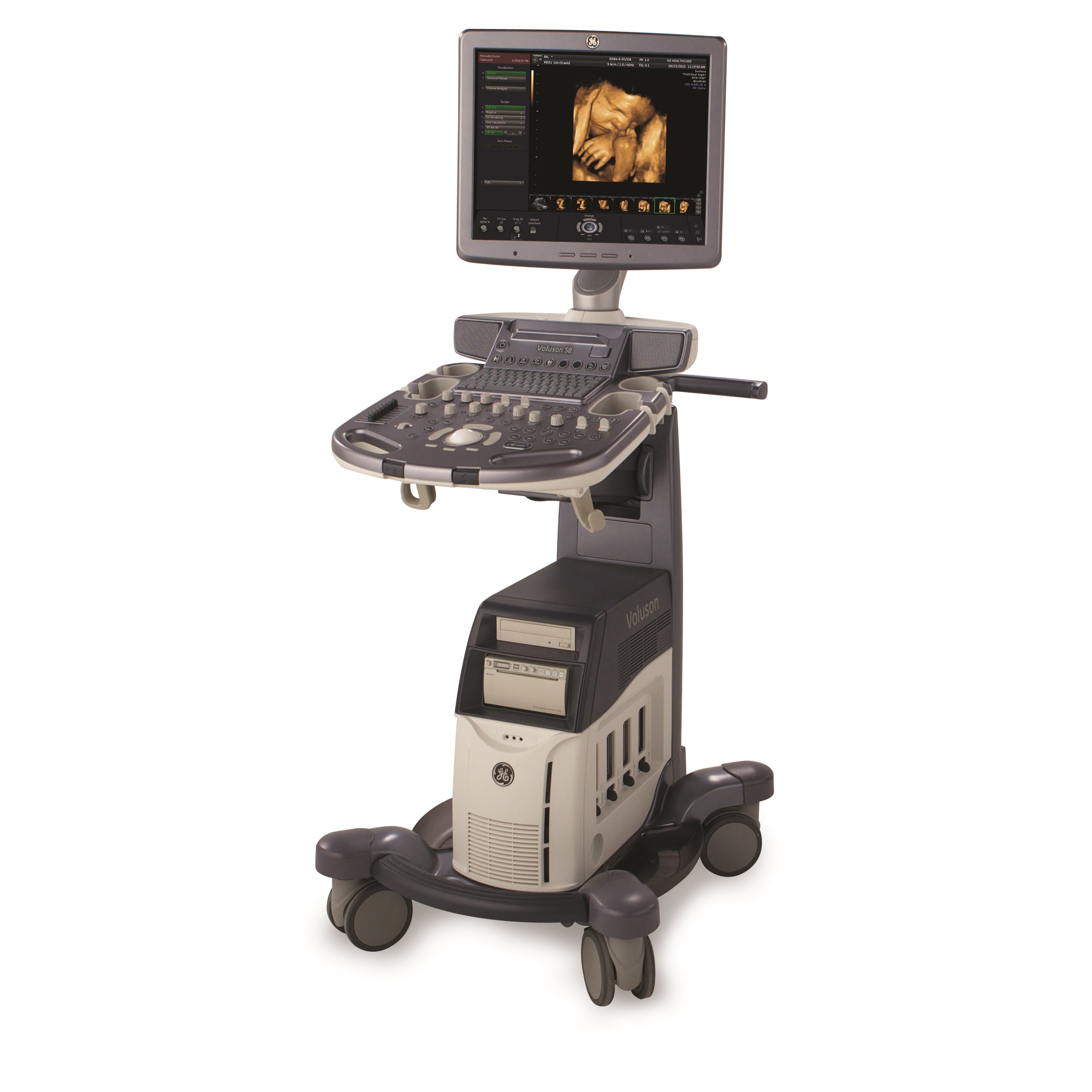 Ultrasonografy stacjonarne wielonarządowe - USG GE Healthcare VOLUSON S8