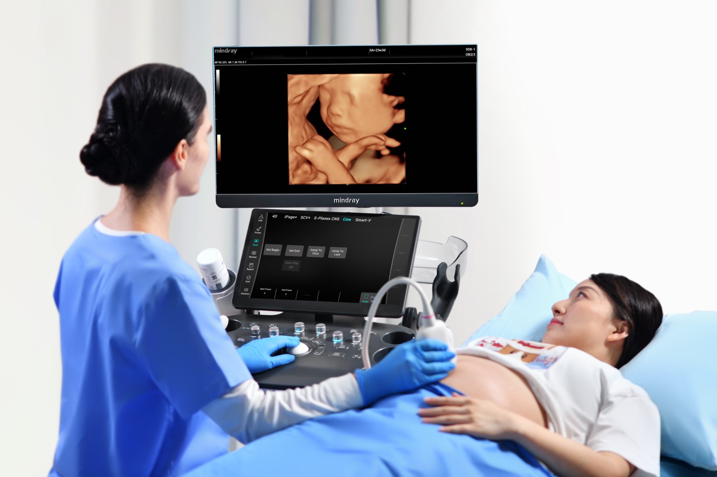 Ultrasonografy stacjonarne wielonarządowe - USG MINDRAY Consona N9
