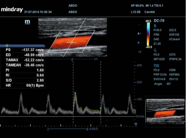 Ultrasonografy stacjonarne wielonarządowe - USG MINDRAY DC-70