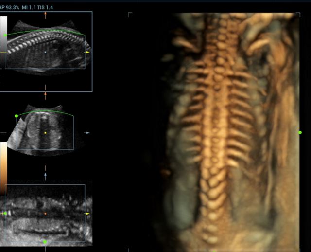 Ultrasonografy stacjonarne wielonarządowe - USG MINDRAY Resona 7