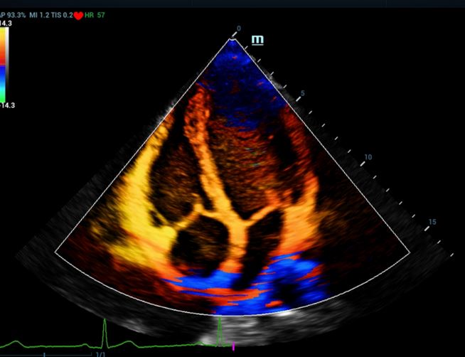 Ultrasonografy stacjonarne wielonarządowe - USG MINDRAY Resona 7