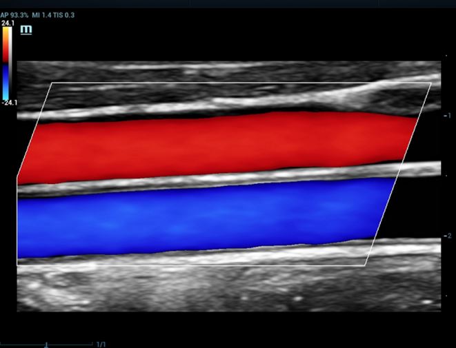Ultrasonografy stacjonarne wielonarządowe - USG MINDRAY Resona 7