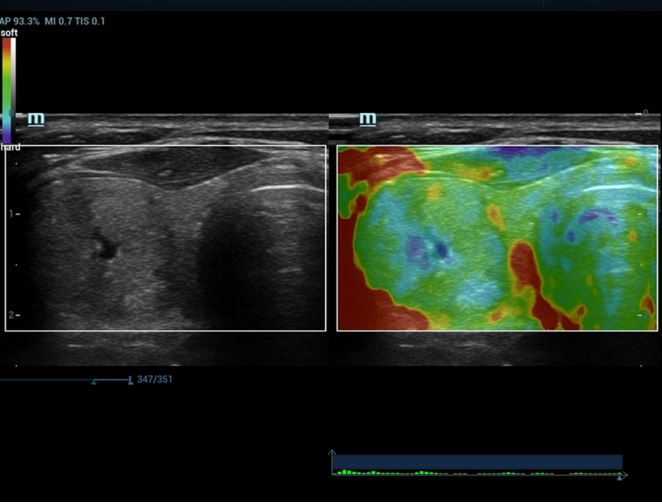 Ultrasonografy stacjonarne wielonarządowe - USG MINDRAY Resona 7