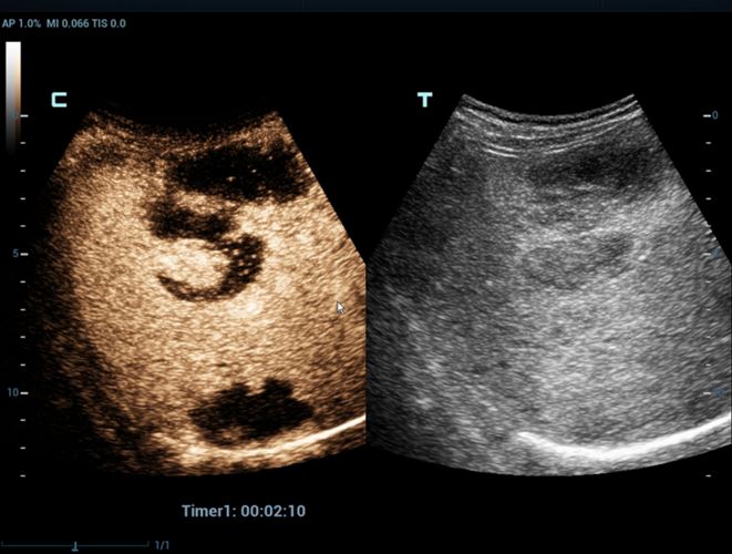 Ultrasonografy stacjonarne wielonarządowe - USG MINDRAY Resona 7