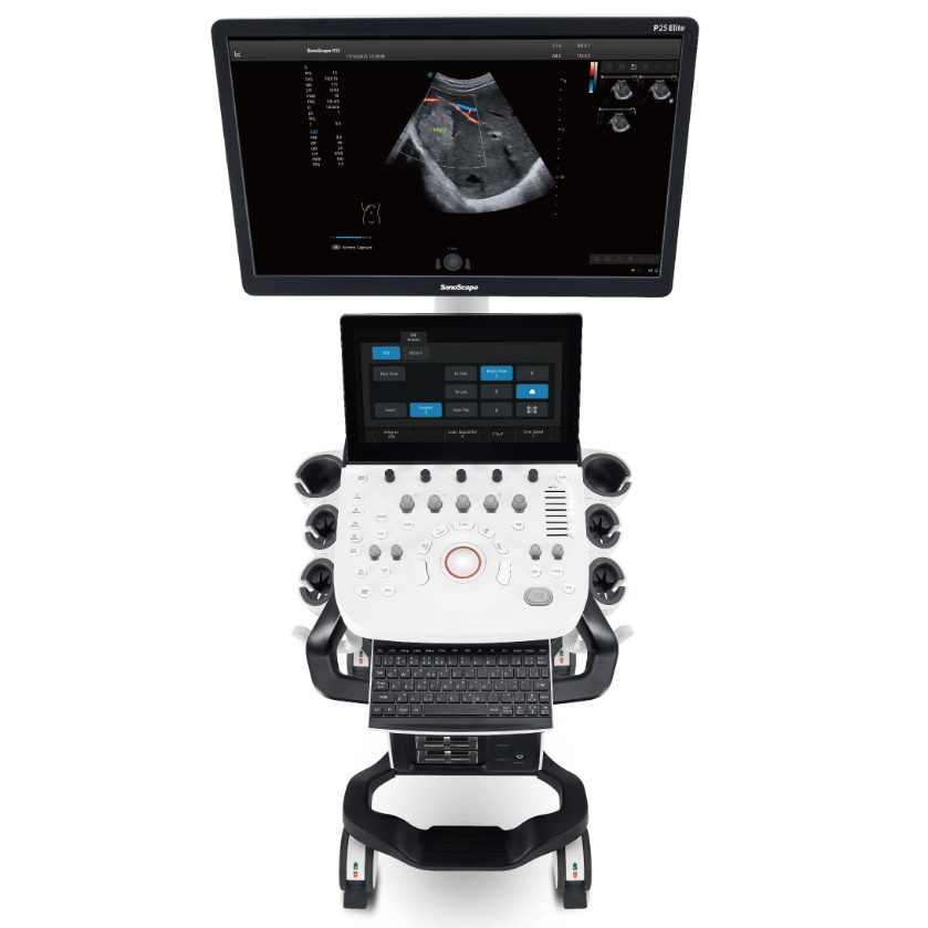 Ultrasonografy stacjonarne wielonarządowe - USG SonoScape P25 Elite