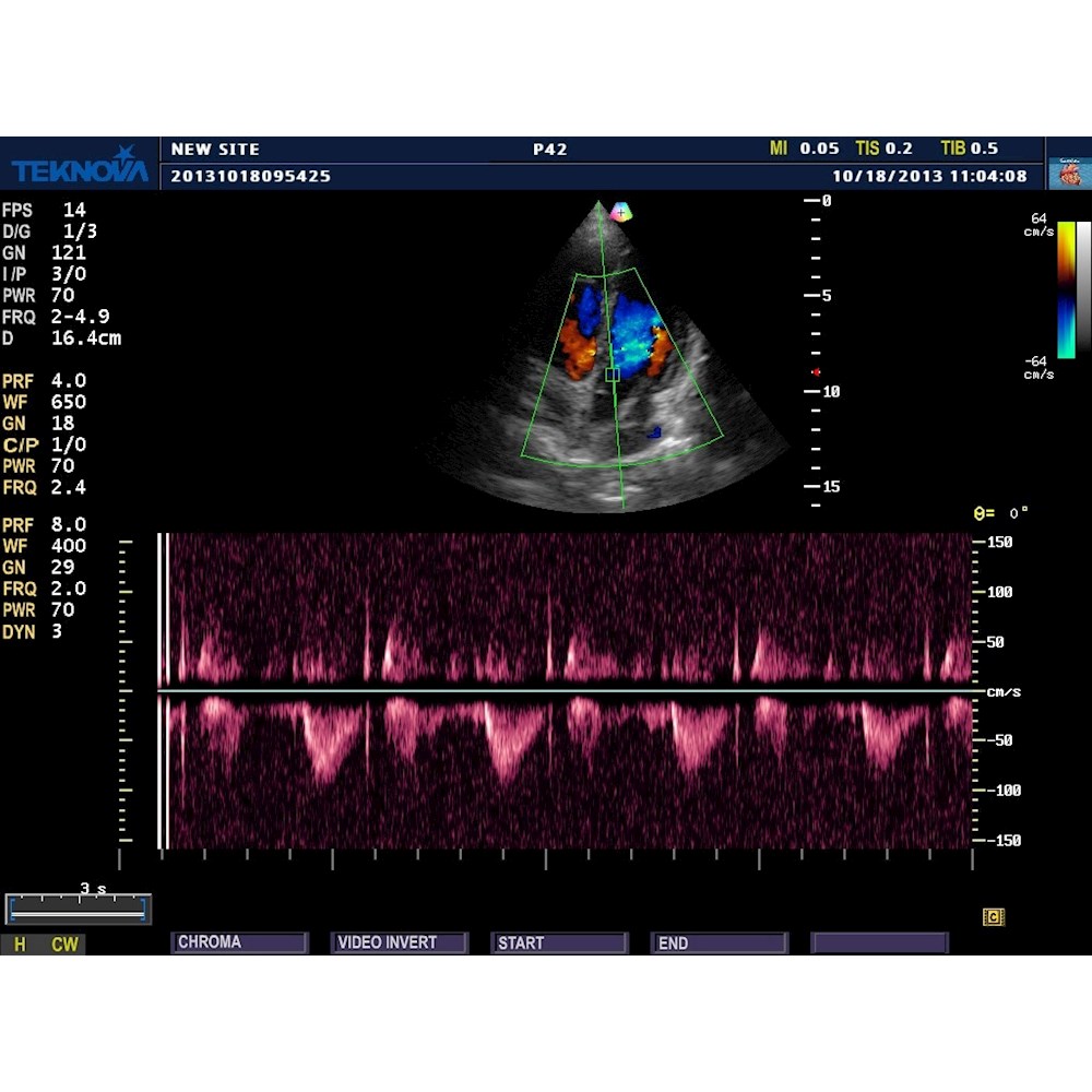 Ultrasonografy stacjonarne wielonarządowe - USG Teknova TH 5500 Expert