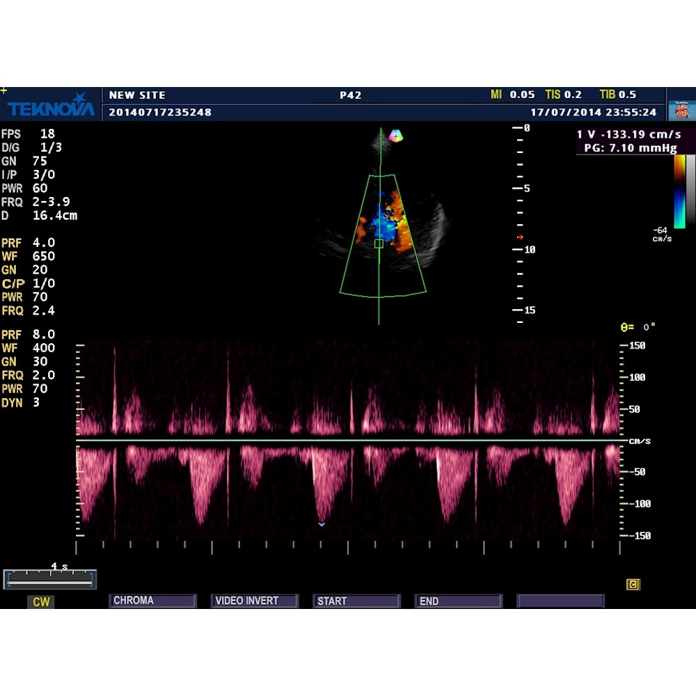 Ultrasonografy stacjonarne wielonarządowe - USG Teknova TH 5500 Expert