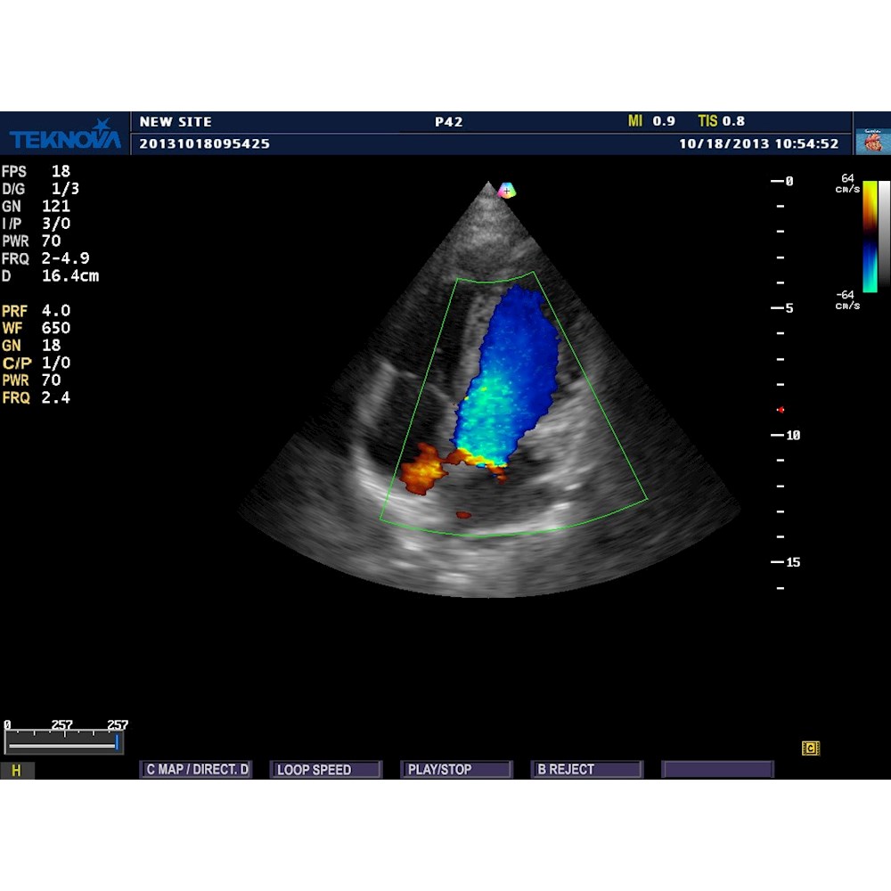 Ultrasonografy stacjonarne wielonarządowe - USG Teknova TH 5500 Expert